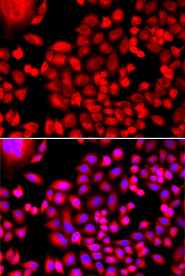 FTHFSDC1 / MTHFD1L Antibody