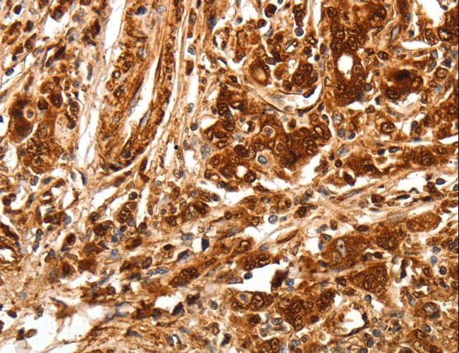 TGFBR1 / ALK5 Antibody