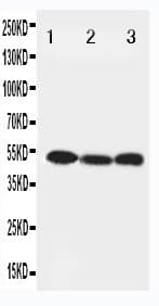 BECN1 / Beclin-1 Antibody (aa222-237)