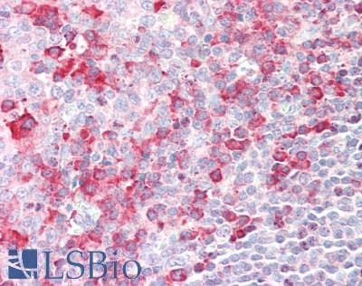 IHC-plus™ Polyclonal Rabbit anti-Human BATF Antibody (aa7-35, IHC, WB)