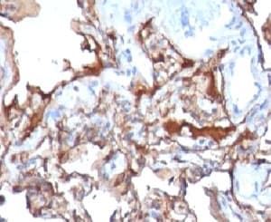 MCAM / CD146 Antibody (clone MCAM/1101)