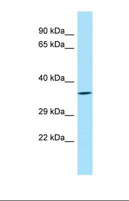 SYT8 Antibody (aa62-111)