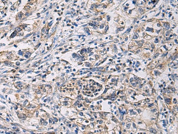 CYTIP Antibody