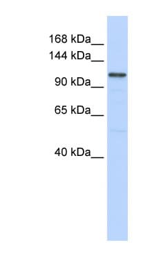 ADCY8 / Adenylate Cyclase 8 Antibody (aa1152-1201)
