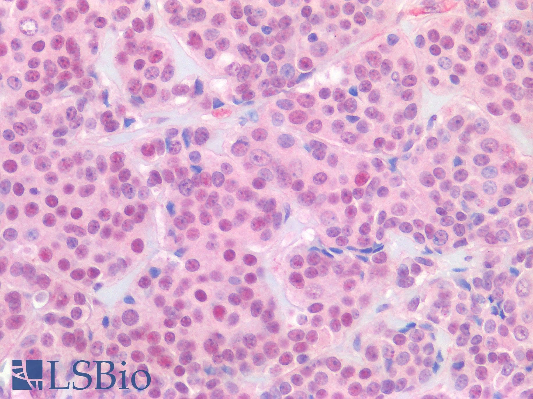 PathPlus™ ER Alpha / Estrogen Receptor Antibody