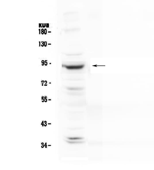 PLA2G6 / IPLA2 Antibody