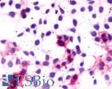 PathPlus™ Polyclonal Rabbit anti-Human CNR1 / CB1 Antibody (C-Terminus, IHC)