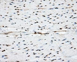 Monoclonal Mouse anti-Human PPP5C Antibody (clone OTI4E1, IHC, WB)