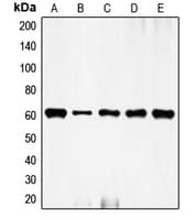 FOS / c-FOS Antibody (N-Terminus)