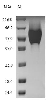 Staphylococcus aureus hlgC Protein (Recombinant 6His, N-terminus)