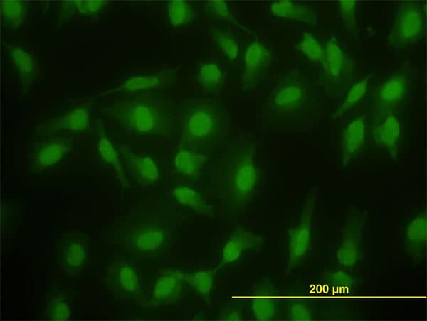 SMAD2 Antibody (clone 3G9)