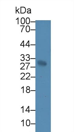 ATP1B3 Antibody (aa66-273)