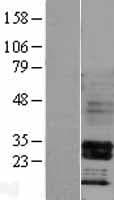 HOXB4 Protein (Over-Expression Lysate Myc-DDK (Flag))