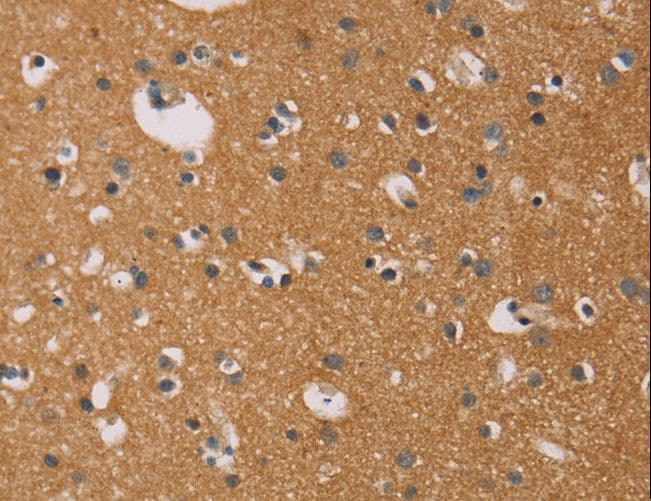 CD22 Antibody