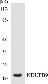 NDUFB9 Antibody (aa85-134)