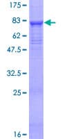 Human SPAM1 / PH20 Protein (Recombinant GST)