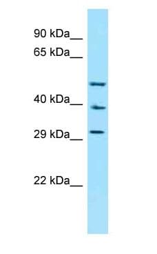 CCKAR / CCK1R Antibody (aa21-70)