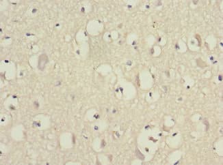 Polyclonal Rabbit anti-Human EIF3S5 / EIF3F Antibody (IHC)