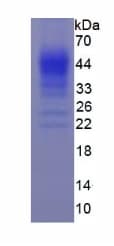 Human IFN Gamma / Interferon Gamma Protein (Recombinant)