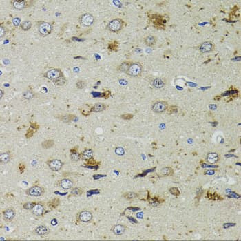 PTPN3 Antibody