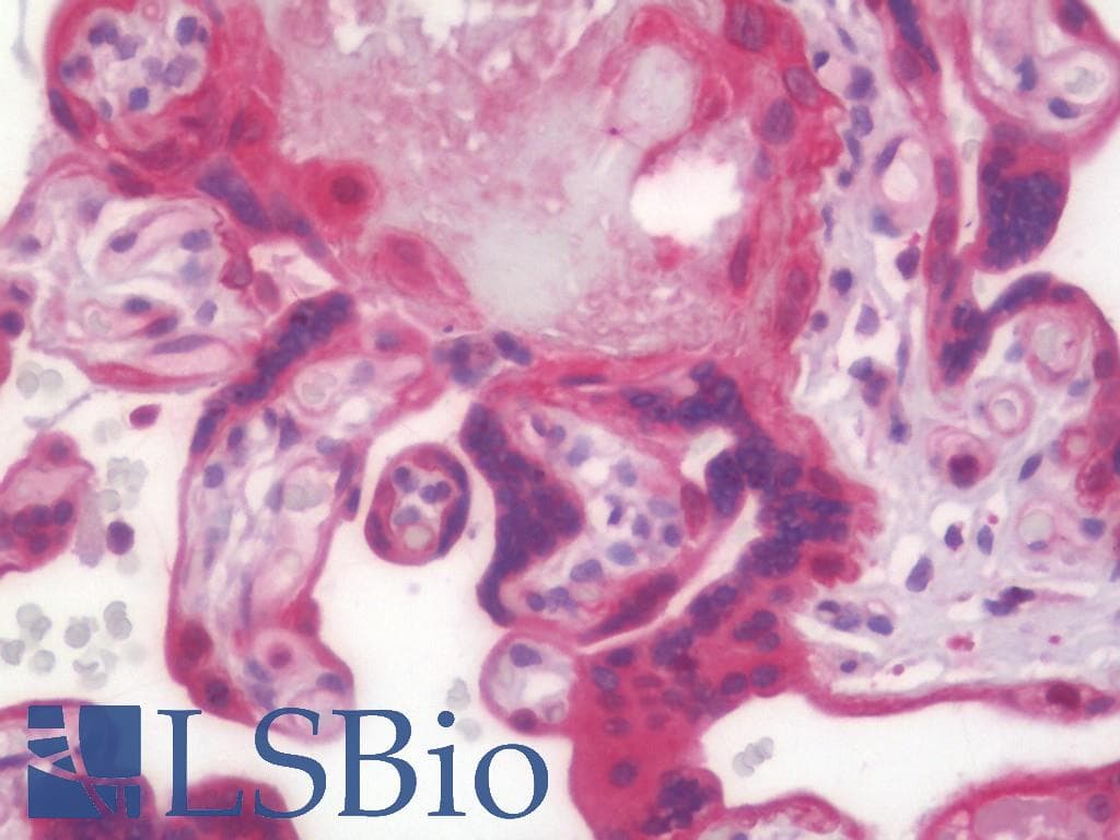 IHC-plus™ CKLF Antibody (aa161-210)