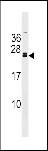 FGF20 Antibody (aa136-165)