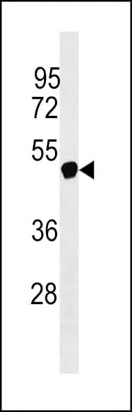Polyclonal Rabbit anti-Human NXF5 Antibody (aa53-80, WB)