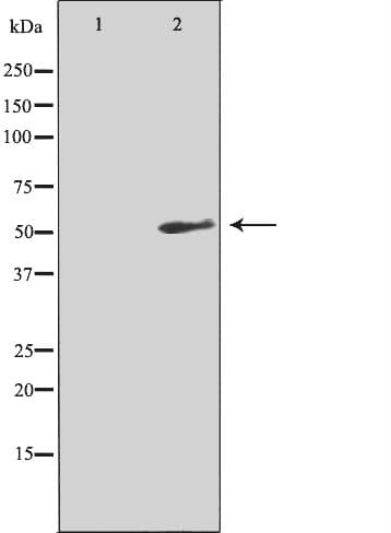 TACR3 / NK3R Antibody