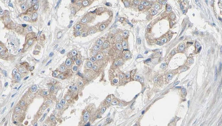 Polyclonal Rabbit anti-Human EIF3B Antibody (IHC, WB)