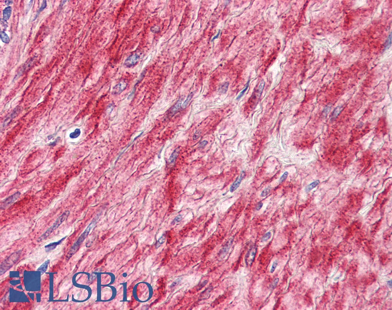 IHC-plus™ Polyclonal Rabbit anti-Human ADGRL4 / ELTD1 Antibody (N-Terminus, IHC)