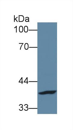 FPGT Antibody (PE)