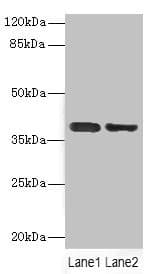 Polyclonal Rabbit anti-Human DNAM-1 / CD226 Antibody (IHC, WB)