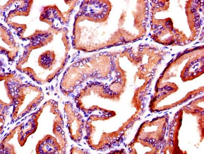 KLK3 / PSA Antibody
