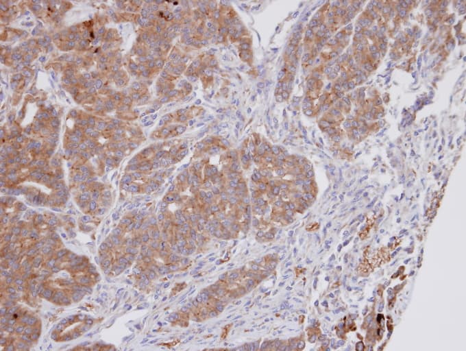 Dipeptidyl Peptidase 3 / DPP3 Antibody (aa138-465)