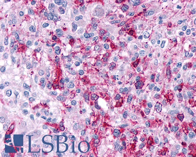 PathPlus™ Polyclonal Rabbit anti-Human CRHR2 / CRF2 Receptor Antibody (Extracellular Domain, IHC)