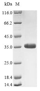 Rotavirus A Rotavirus VP7 Protein (Recombinant 10His, N-terminus + Myc, C-terminus)