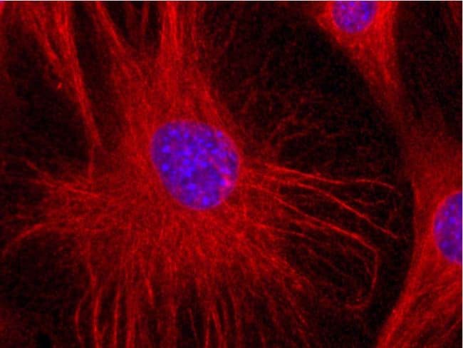 Vimentin Antibody (clone VI-01)