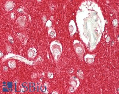 IHC-plus™ Monoclonal Mouse anti-Human THY1 / CD90 Antibody (clone 7E1B11, aa17-132, IHC, IF, WB)
