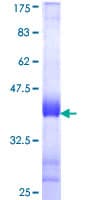 Human GOLGB1 / Giantin Protein (Recombinant GST, N-terminus)