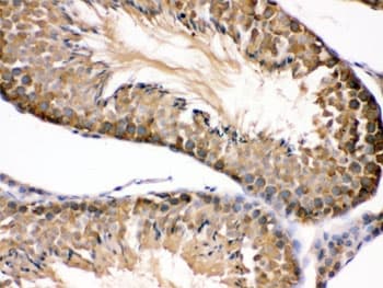 Polyclonal Rabbit anti-Human HSP90 Beta Antibody (IHC, WB)