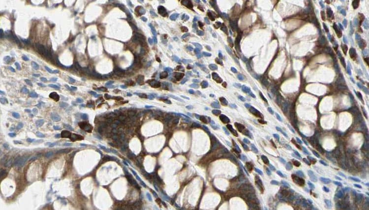 Polyclonal Rabbit anti-Human ADAM8 Antibody (IHC, WB)
