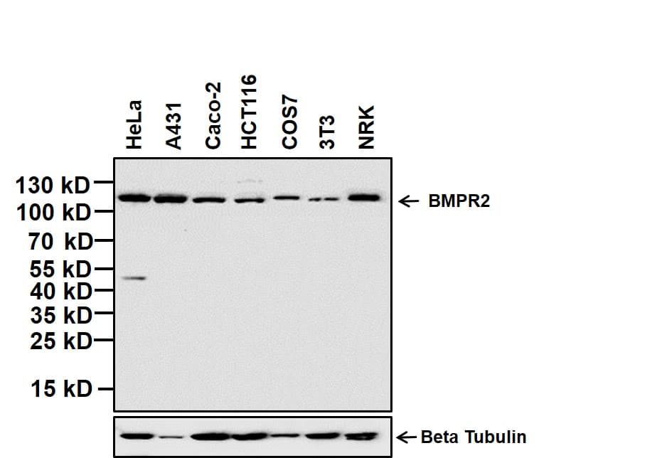 BMPR2 Antibody (clone 3F6F8)