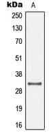 GJB1 / CX32 / Connexin 32 Antibody (Internal)
