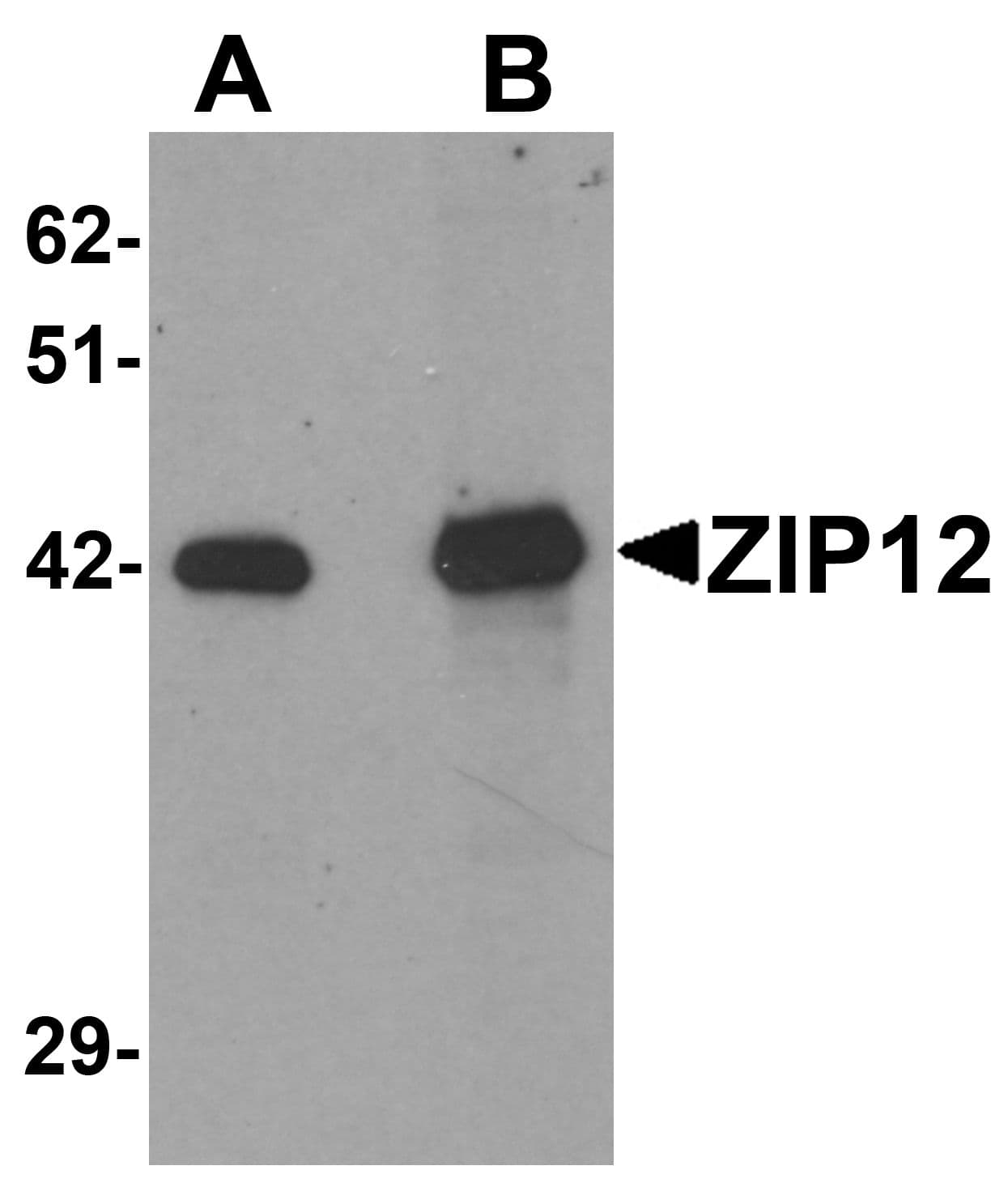 SLC39A12 / ZIP12 Antibody
