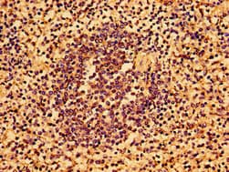 Polyclonal Rabbit anti-Human AAGAB Antibody (IHC, IF)
