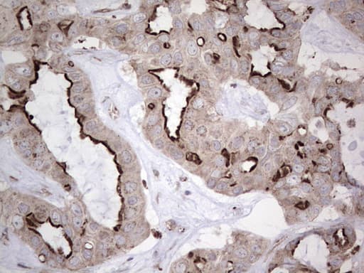 NR1I3 / CAR Antibody (aa1-236, clone OTI1C6)