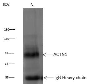 ACTA1 / Skeletal Muscle Actin Antibody (Preservative Free)