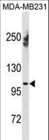 Polyclonal Rabbit anti-Human ENPP1 Antibody (aa6-34, WB)