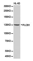 Polyclonal Rabbit anti-Human PLCB1 / Phospholipase C Beta 1 Antibody (IHC, WB)