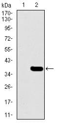 Monoclonal Mouse anti-Human SLC27A5 / BACS Antibody (clone 4B11C10, aa508-570, IHC, WB)